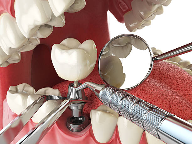 Best Orthodontic Emergency Dentist in Middleport, OH